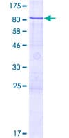 Human ZNF530 Protein (Recombinant GST)