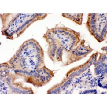FUT1 / HSC Antibody (aa134-164)