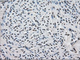 FKBP5 / FKBP51 Antibody (clone OTI3E9)