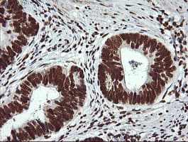 THUMPD1 Antibody (clone OTI1H6)