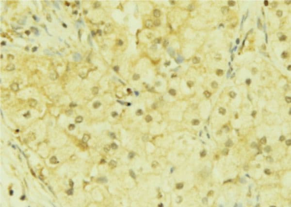 Polyclonal Rabbit anti-Human DACH / DACH1 Antibody (IHC, WB)