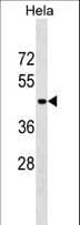 SERPINB11 / EPIPIN Antibody (aa170-196)