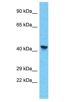 PRAMEF11 Antibody (aa182-231)