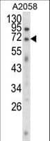 Polyclonal Rabbit anti-Human EWSR1 / EWS Antibody (aa628-656, IF, WB)