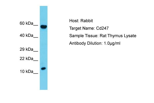 CD247 / CD3 Zeta Antibody (C-Terminus)