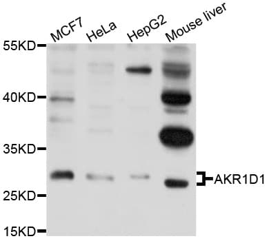 AKR1D1 Antibody