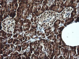 LMO2 Antibody (clone OTI1G10)