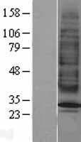 MC2R / ACTHR / ACTH Receptor Protein (Over-Expression Lysate Myc-DDK (Flag))