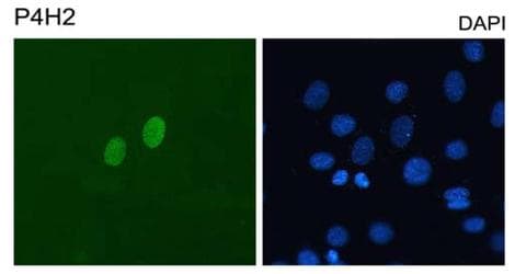 DUX4 Antibody (C-Terminus, clone P4H2)
