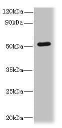Polyclonal Rabbit anti-Human SNX6 Antibody (IHC, WB)