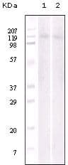 EPHB6 / EPH Receptor B6 Antibody (clone 8E7H12)