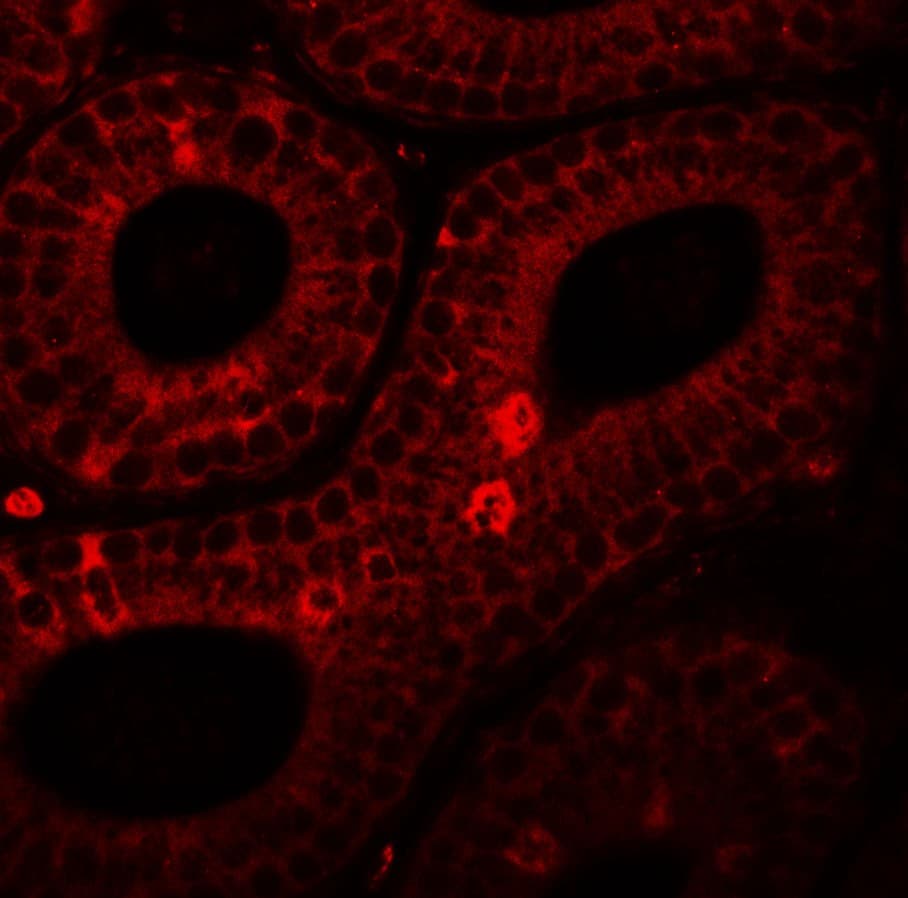 IHC-plus™ SPINK2 Antibody