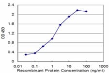 RBM6 / 3G2 Antibody (clone 3E9)