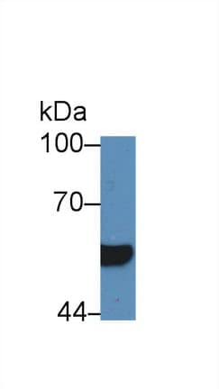 HNF1B / HNF1 Beta Antibody (aa159-300)