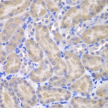 UBXD9 / ASPL Antibody (aa284-553)