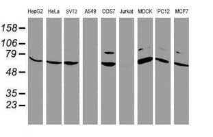 FBXO21 Antibody (clone OTI2C7)