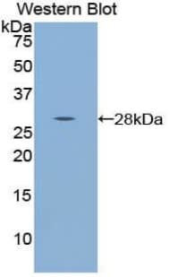 WARS Antibody (aa140-347)
