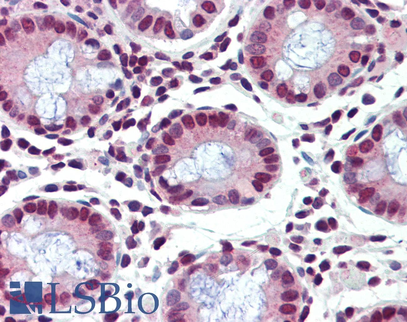 FUBP1 Antibody (aa540-589)