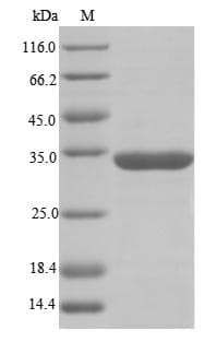 Human RBMX Protein (Recombinant GST, N-terminus)