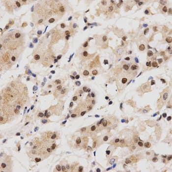 QIP1 / KPNA4 Antibody