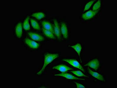 NAP1 / TAB3 Antibody