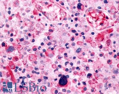 PathPlus™ Polyclonal Rabbit anti-Human ADGRF4 / GPR115 Antibody (C-Terminus, IHC)