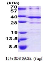 Human BSND / Barttin Protein (Recombinant His)