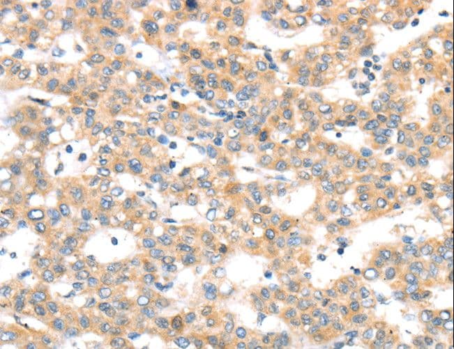 RAB24 Antibody