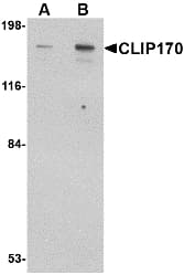 CLIP1 / CLIP-170 Antibody