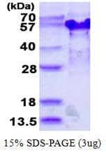 Human TSSC4 Protein (Recombinant His)