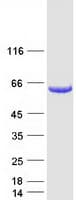 Human IRF5 Protein (Recombinant Myc-DDK (Flag))