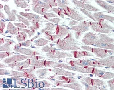 DSP / Desmoplakin Antibody (aa2609-2822)