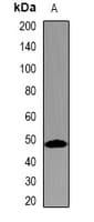 IHC-plus™ Polyclonal Rabbit anti-Human TMPRSS2 / Epitheliasin Antibody (IHC, WB)