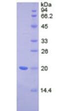 Human IL17RD Protein (Recombinant His, N-Terminal)
