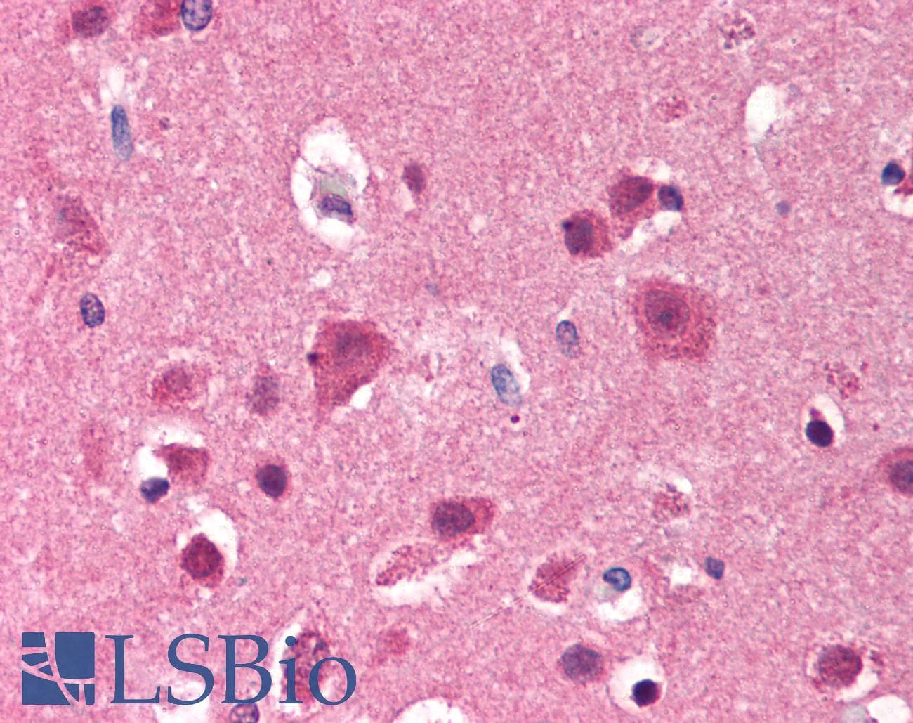IHC-plus™ Monoclonal Mouse anti-Human SYN / FYN Antibody (clone FYN-01, aa7-176, IHC, WB)