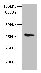 Polyclonal Rabbit anti-Human AASDHPPT / LYS5 Antibody (aa1-309, IHC, WB)
