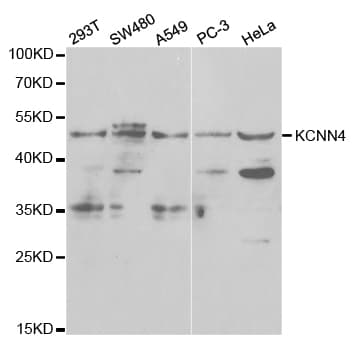 Polyclonal Rabbit anti-Human KCNN4 / KCa3.1 Antibody (WB)