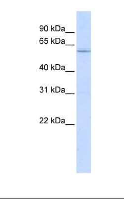 LRRC15 Antibody (aa74-123)