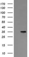 ASGR2 Antibody (clone OTI4B6)