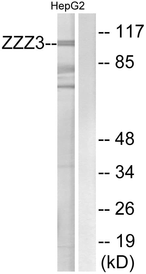 Polyclonal Rabbit anti-Human ATAC1 / ZZZ3 Antibody (aa341-390, WB)