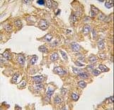 ACTC1 / Alpha Cardiac Actin Antibody (aa38-67)