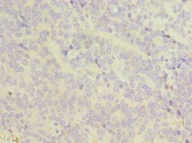 I-BABP / FABP6 Antibody (aa1-128)