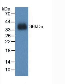 GSR / Glutathione Reductase Antibody (aa240-500)