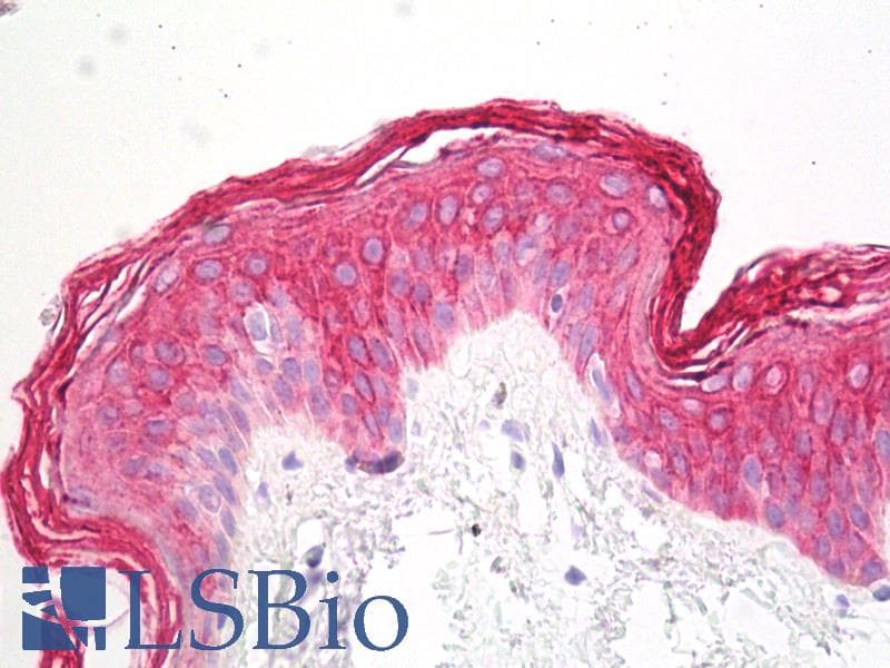 IHC-plus™ Monoclonal Mouse anti-Human Pan Cytokeratin Antibody (clone C-11, IHC, WB)