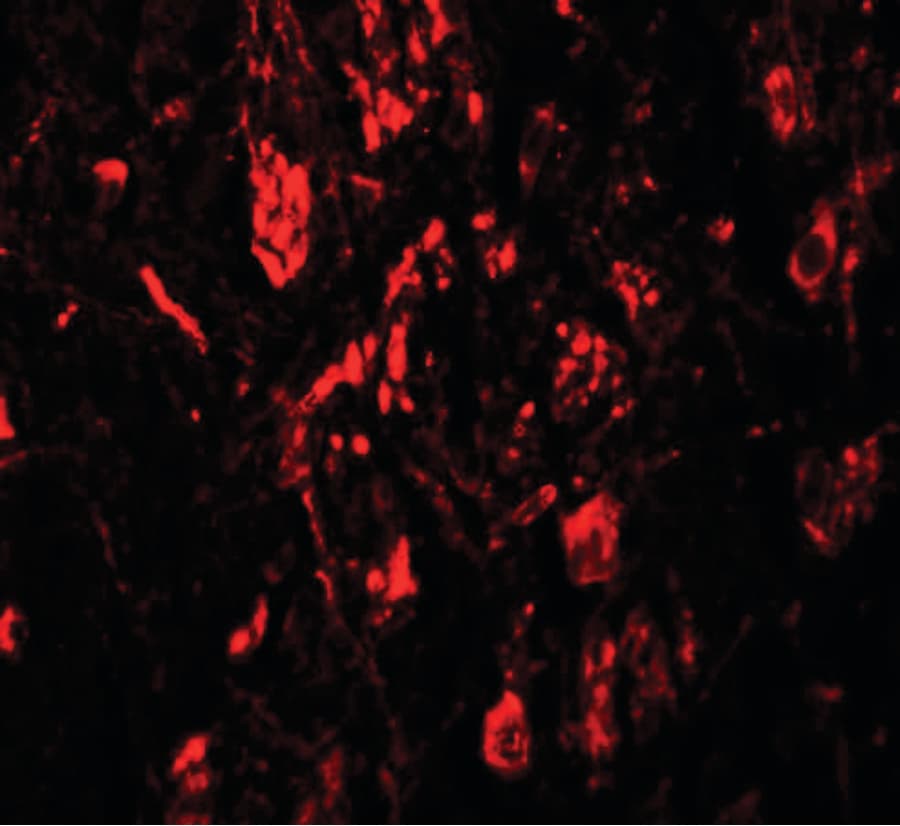 IHC-plus™ Polyclonal Rabbit anti-Human LRRTM4 Antibody (IHC, IF, WB)
