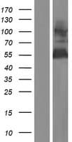 GOLM1 / GP73 / GOLPH2 Protein (Over-Expression Lysate Myc-DDK (Flag))