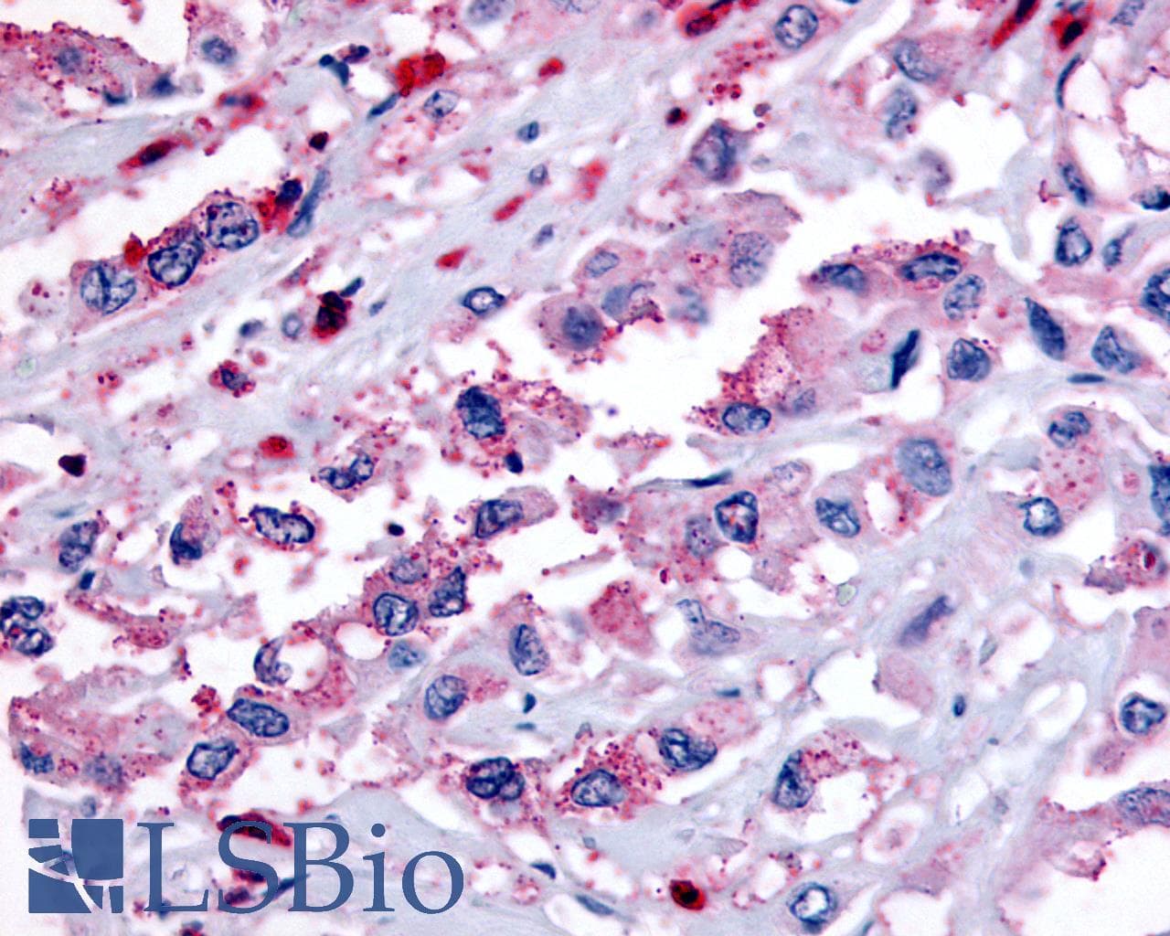 PathPlus™ Polyclonal Rabbit anti-Human GPR65 / TDAG8 Antibody (Cytoplasmic Domain, IHC)