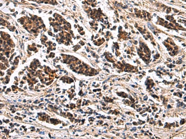 ARPC1B / p41-ARC / ARP2 Antibody