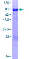 Human RARB / RAR Beta Protein (Recombinant GST)