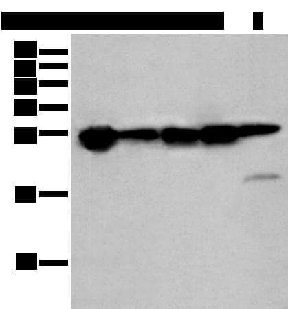 HSPB1 / HSP27 Antibody